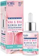 Victoria Beauty Blemish Out AHA & BHA Face Serum - 
